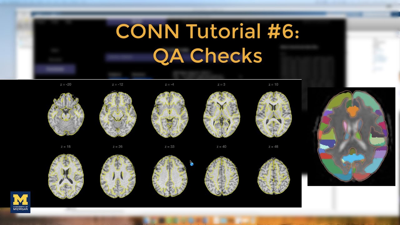 CONN Tutorial #6: QA Checks