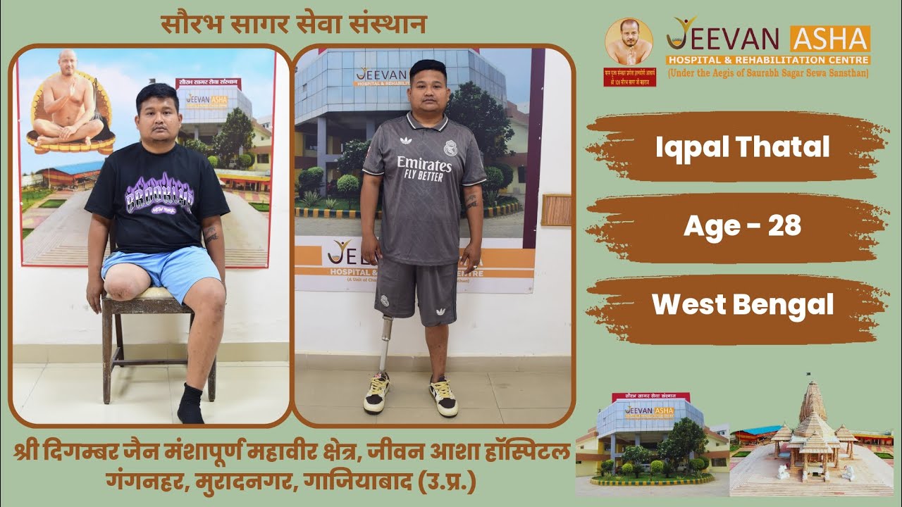 Iqpal lost right leg in a accident Jeevan Asha Hospital provided him free of cost Modular Prosthesis