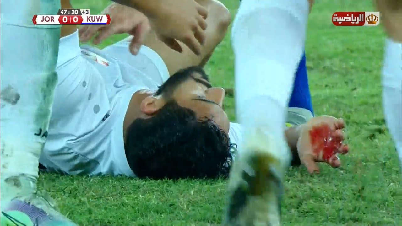 لحظة اصابة موسى التعمري اثناء مباراة المنتخب مع الكويت ضمن التصفيات الآسيوية