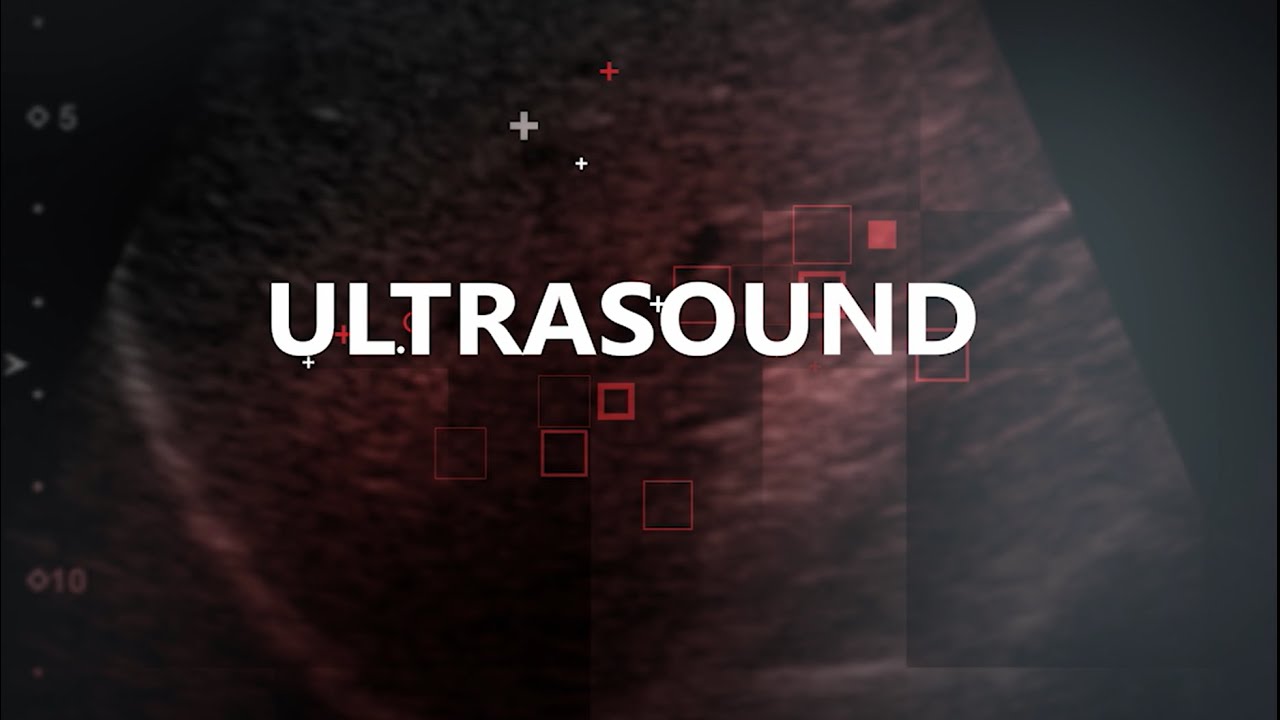 Canon Medical ANZ Product & Technology Update 2021 - Ultrasound
