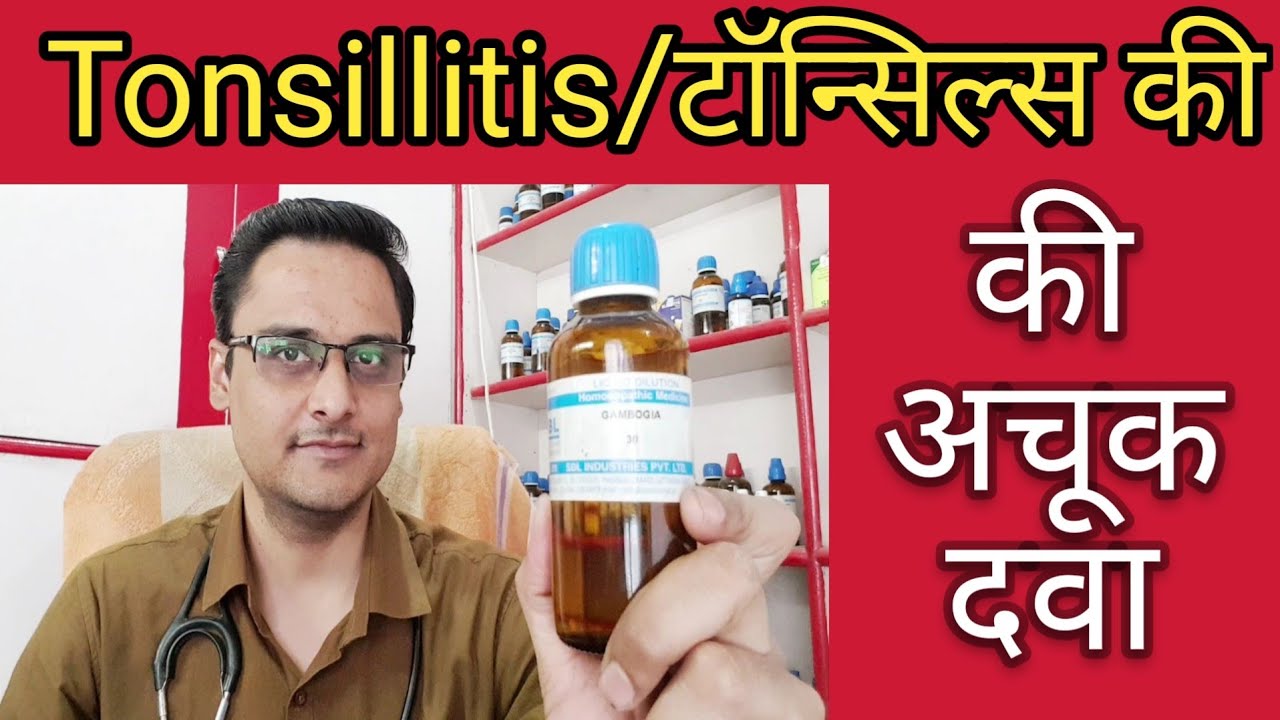 tonsillitis homeopathic treatment - टॉन्सिल्स का अचूक उपचार