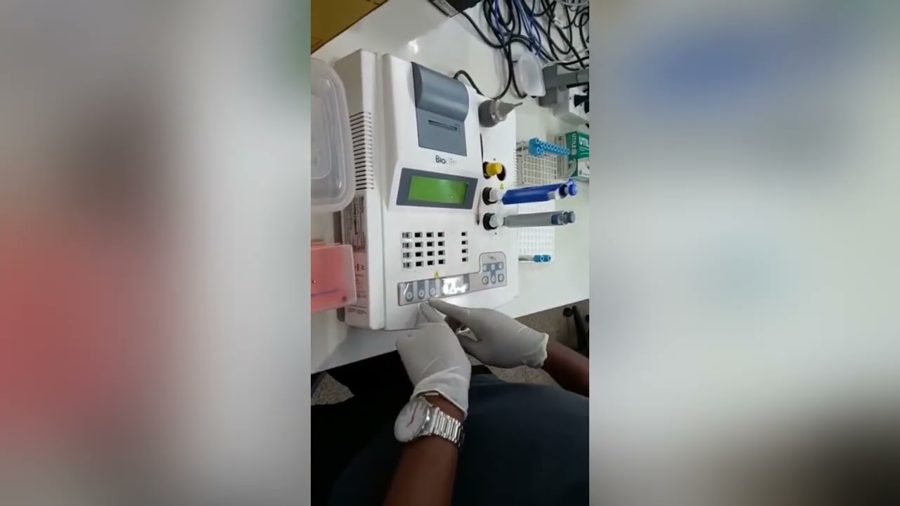 Coagulograma (TP/TTPA)