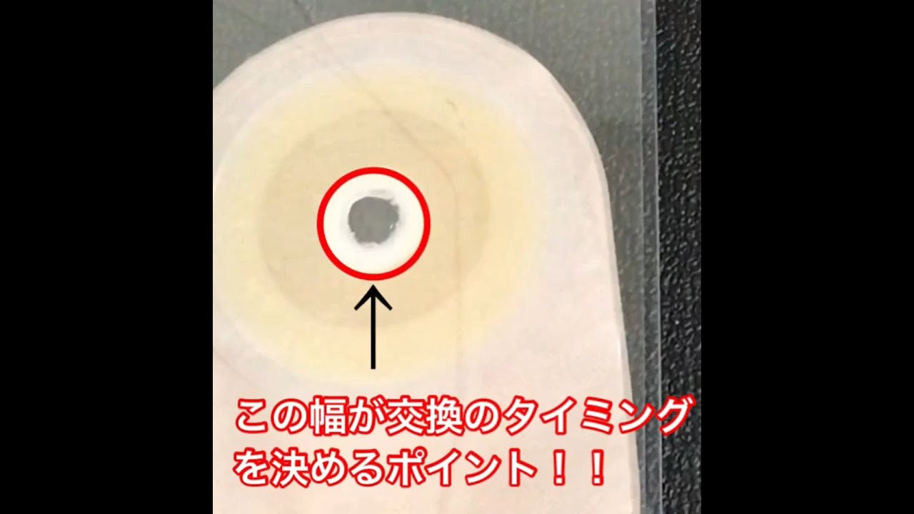 ストーマ装具交換のタイミングはいつ？