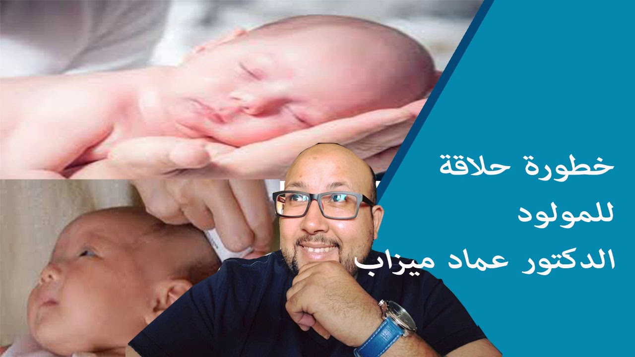 حلاقة المولود بين العادات  وسلامة الطفل الدكتور عماد ميزاب