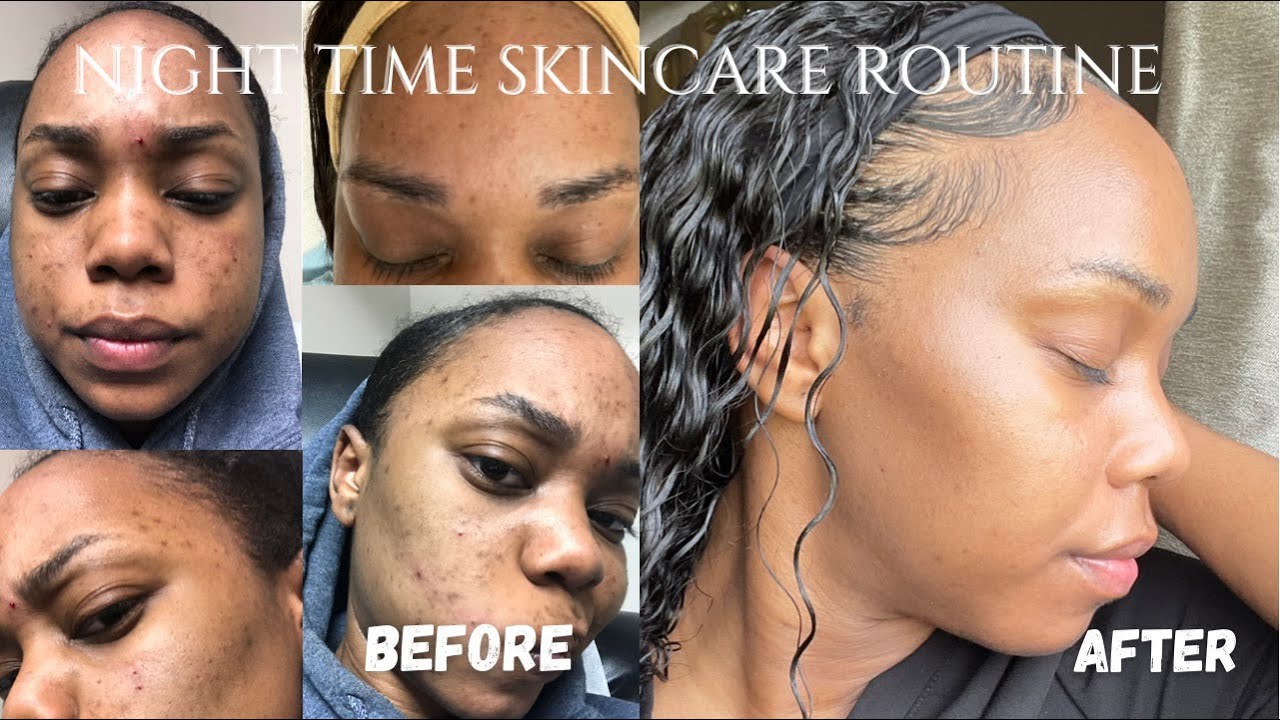 NIGHT TIME SKINCARE ROUTINE | HOW I ACHIEVED CLEAR SKIN IN 2021✨ | ALL THINGS POLY