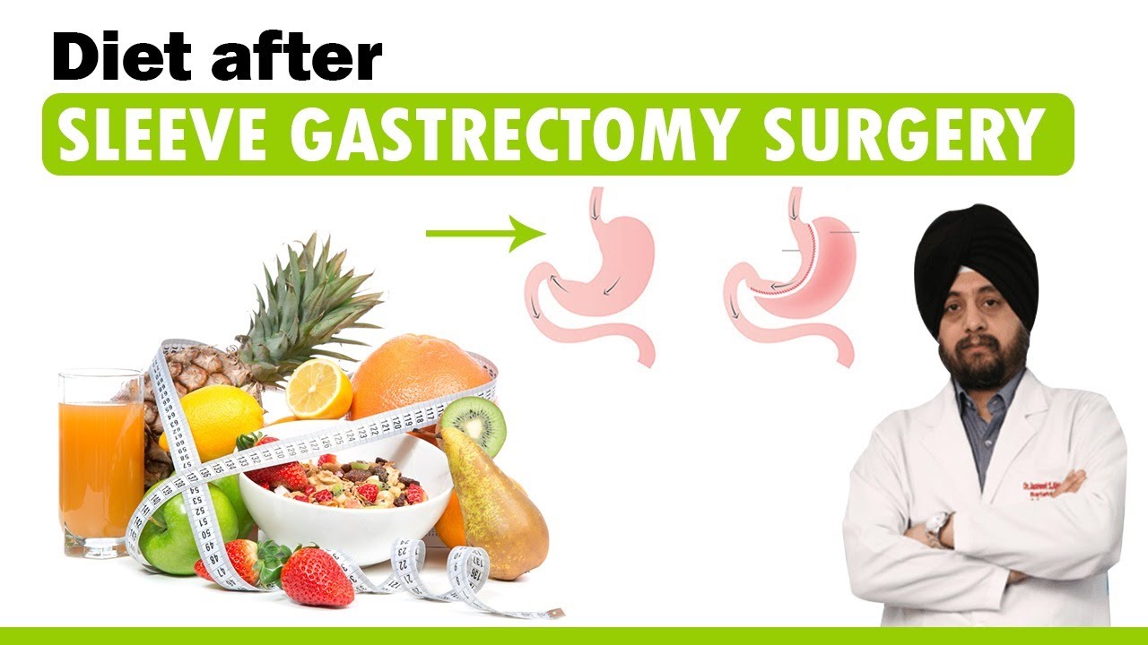 Gastric Sleeve Diet After Surgery, What to eat after Gastric Sleeve surgery, Sleeve Gastrectomy Diet