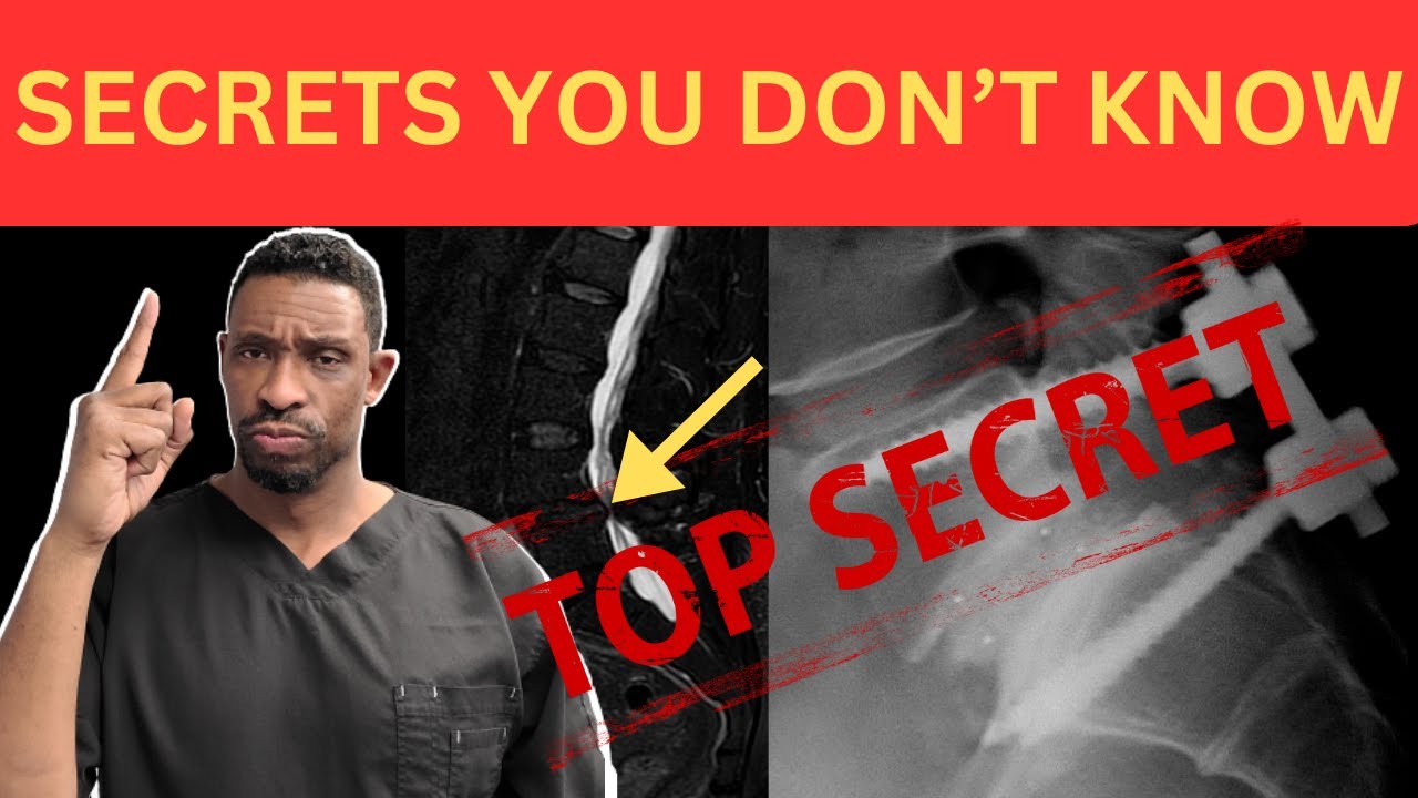 Spinal Stenosis: Best choice you're not told about as a layperson
