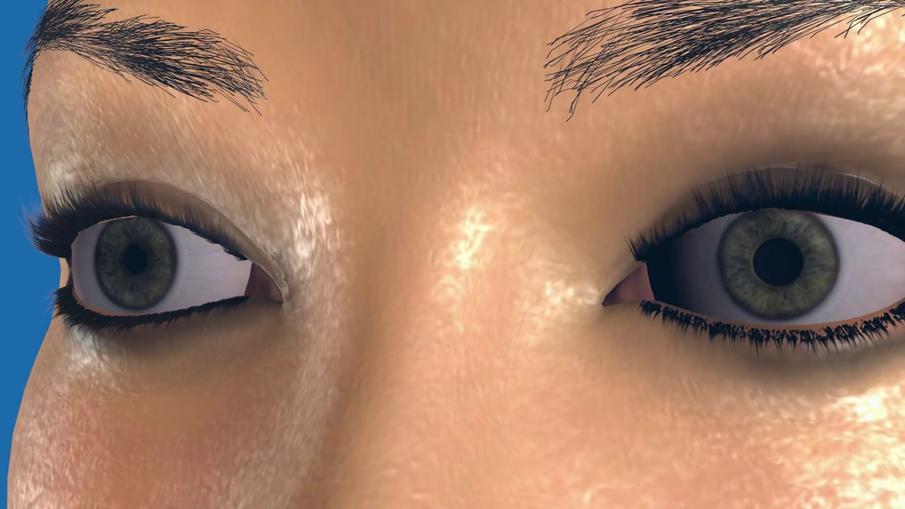 Dilation Exam