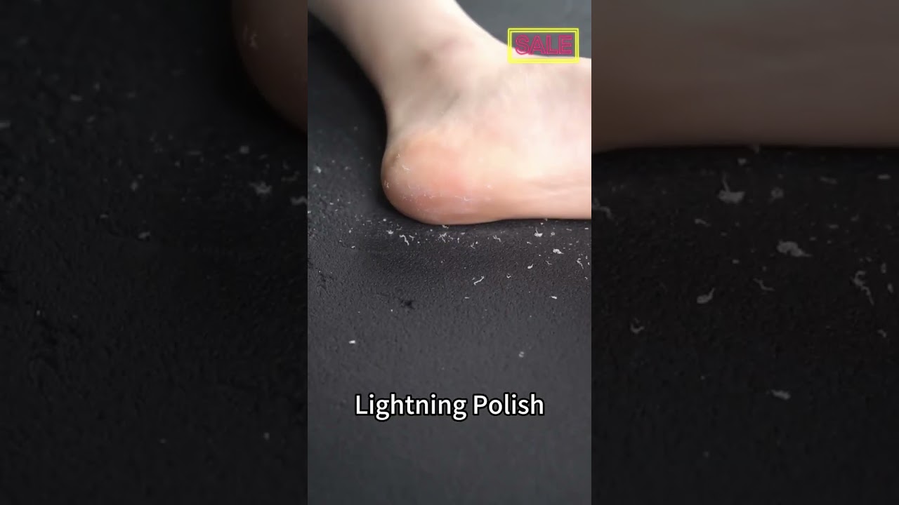 Feet’s ChatGTP Era: AI That Reads Your Heel Struggles 