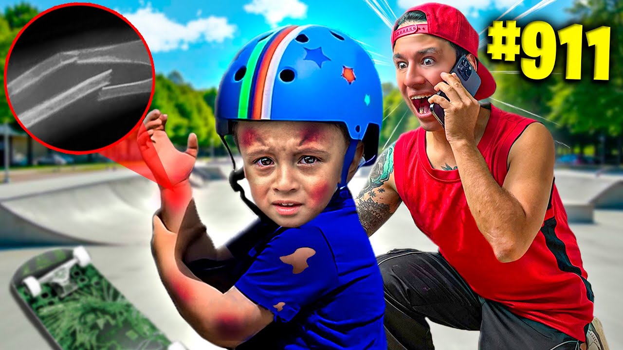 &iexcl;MI HIJO SE ROMPE un BRAZO HACIENDO SKATE por PRIMERA VEZ! *