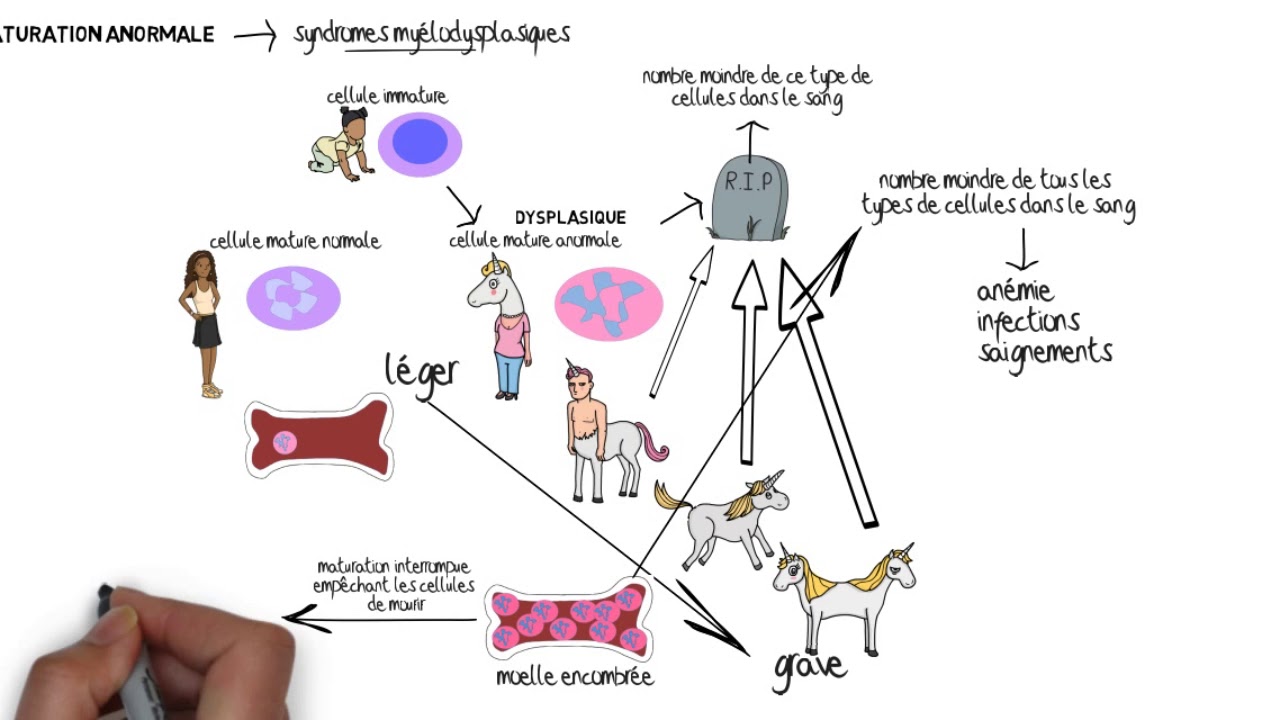Comprendre les troubles myéloprolifératifs et les syndromes myélodysplasiques