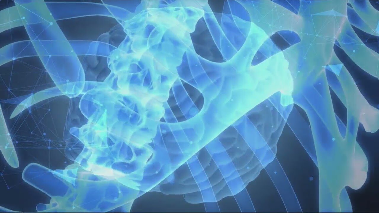 HealthWatch: A life-saving weight loss surgery