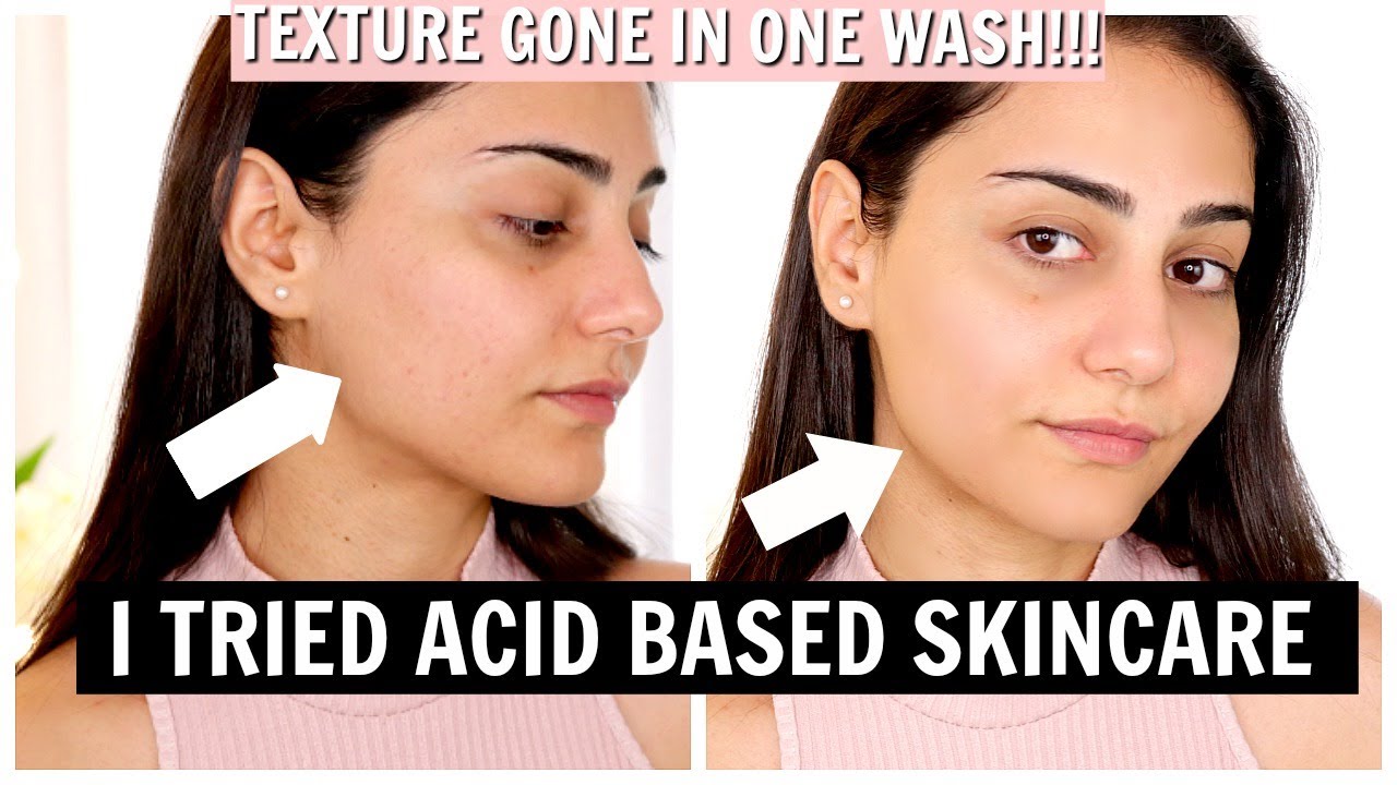 I TRIED CHEMICAL EXFOLIATORS FOR FIRST TIME | ACID SKINCARE | SIMMY GORAYA