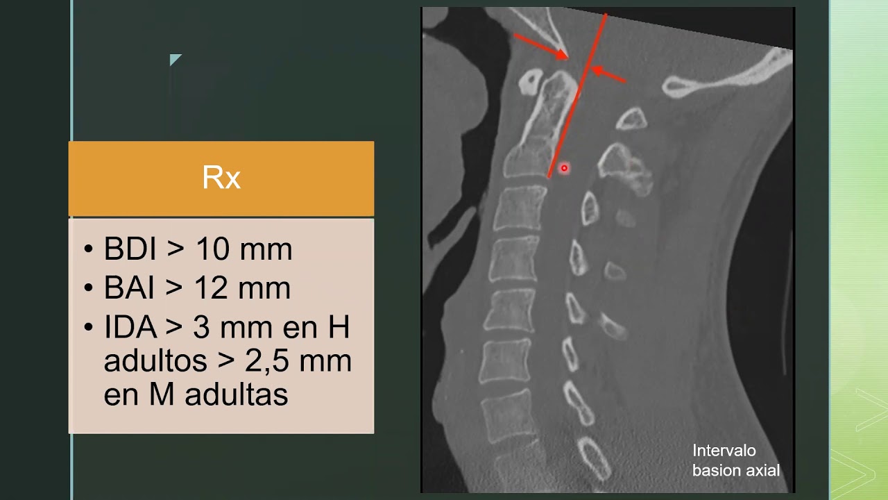 PATOLOGÍA TRAUMÁTIA DE COLUMNA VERTEBRAL
