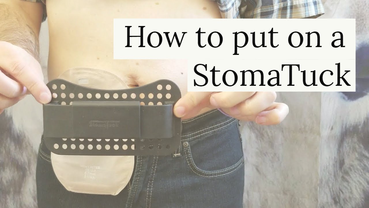How to use the StomaTuck (Ostomy accessory)