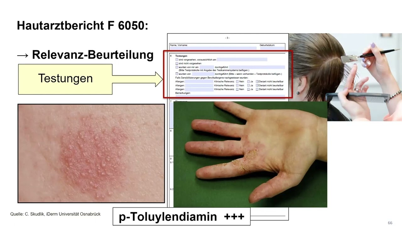 Berufsdermatologie Teil 3: Diagnostik