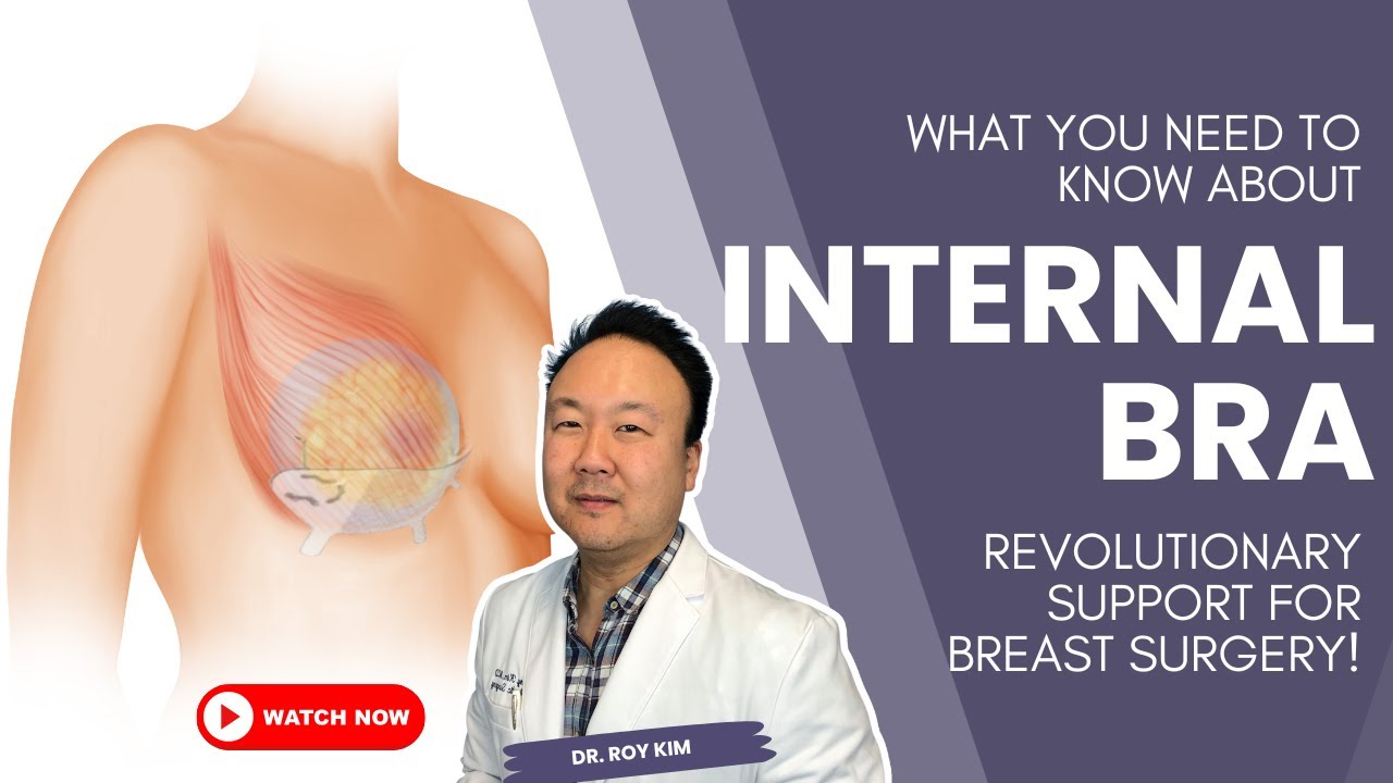 What You Need to Know About Internal Bra | Dr. Roy Kim