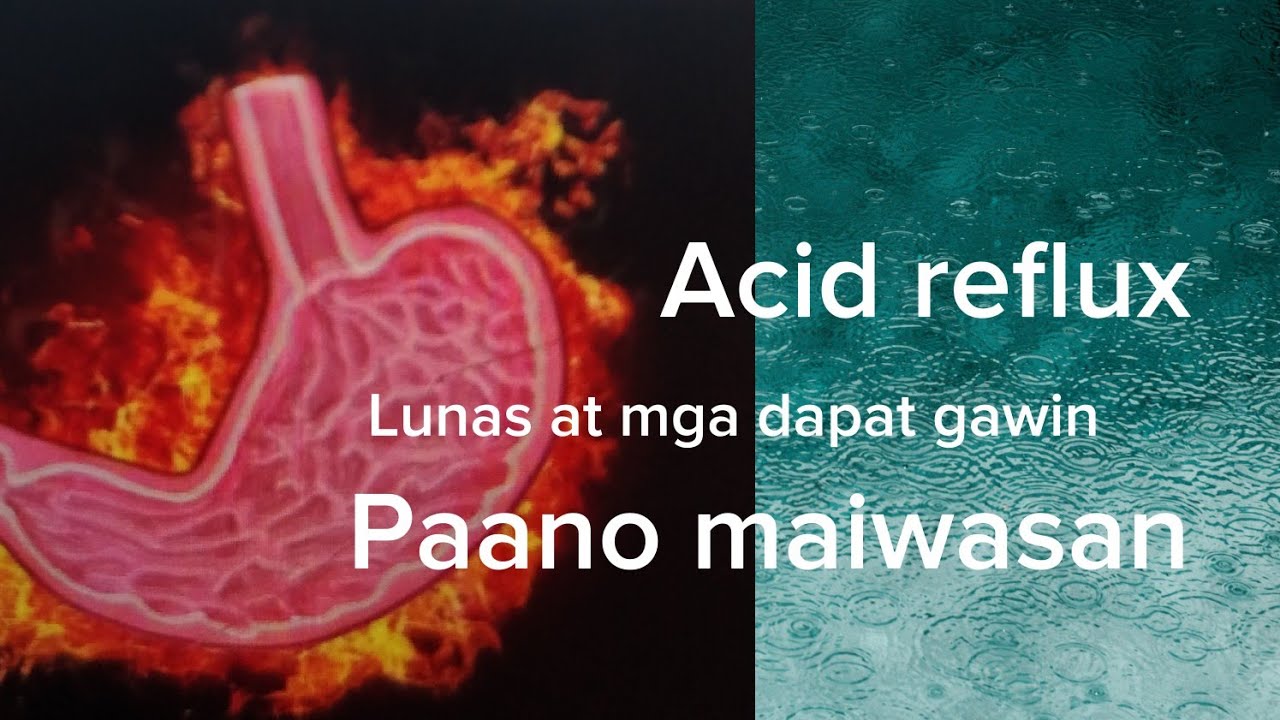 Acid reflux. Paano maiwasan? Lunas at mga dapat gawin@lovelylyn