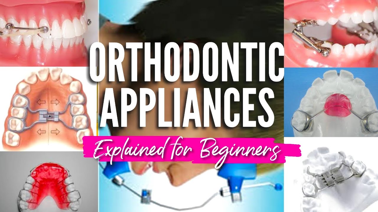 ORTHODONTIC APPLIANCES EXPLAINED