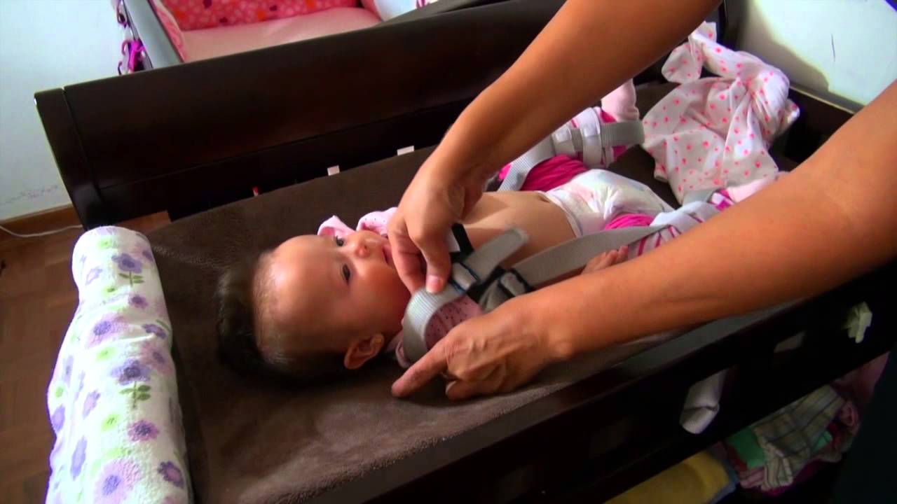 Displasia de Caderas: ¿Cómo vestir a tu bebé con el arnés de pavlik?