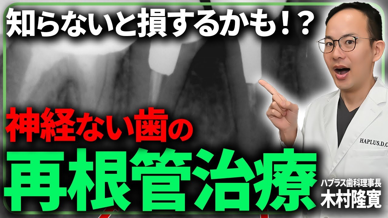 【保存版】根管の再治療はとても難しいです...再根管治療をやったほうが歯が長持ちする人とは？