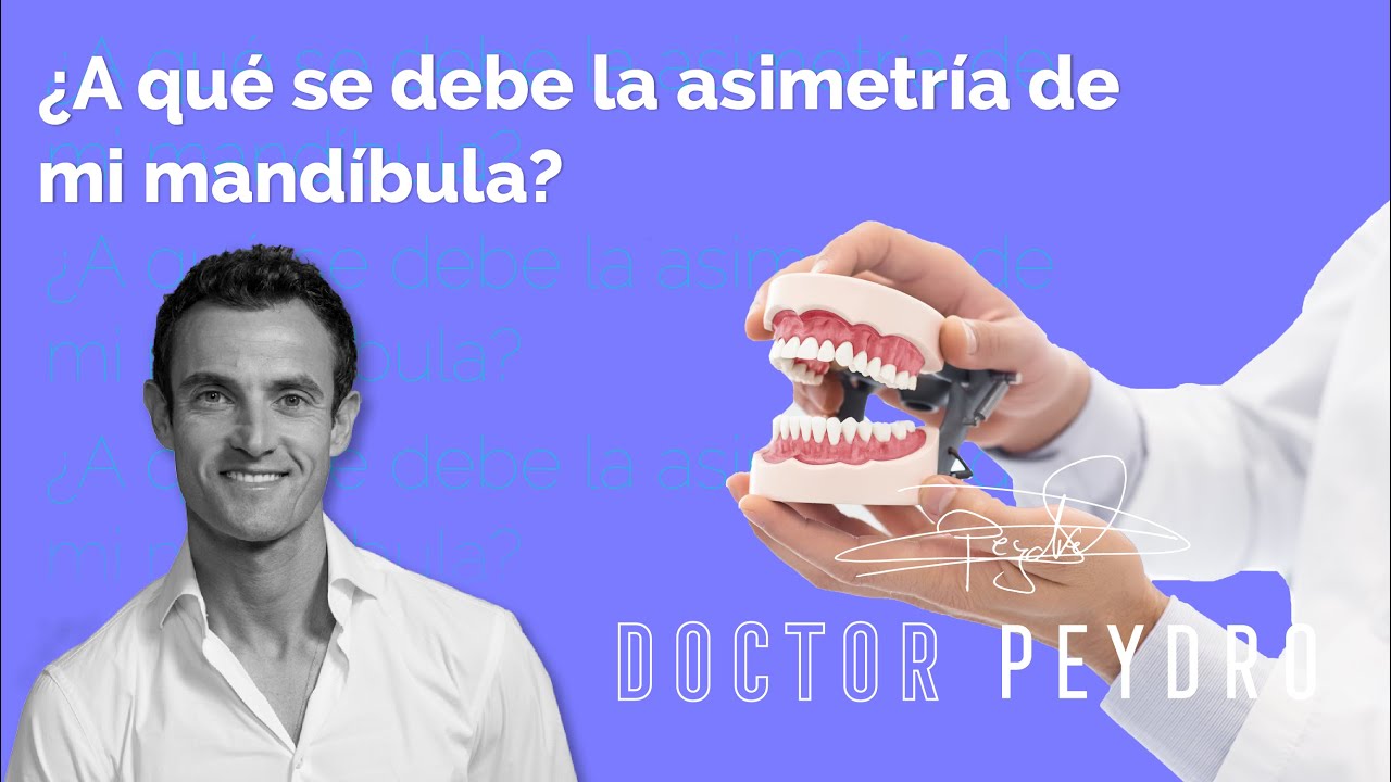Cómo solucionar una mandíbula asimétrica con ORTODONCIA INVISIBLE