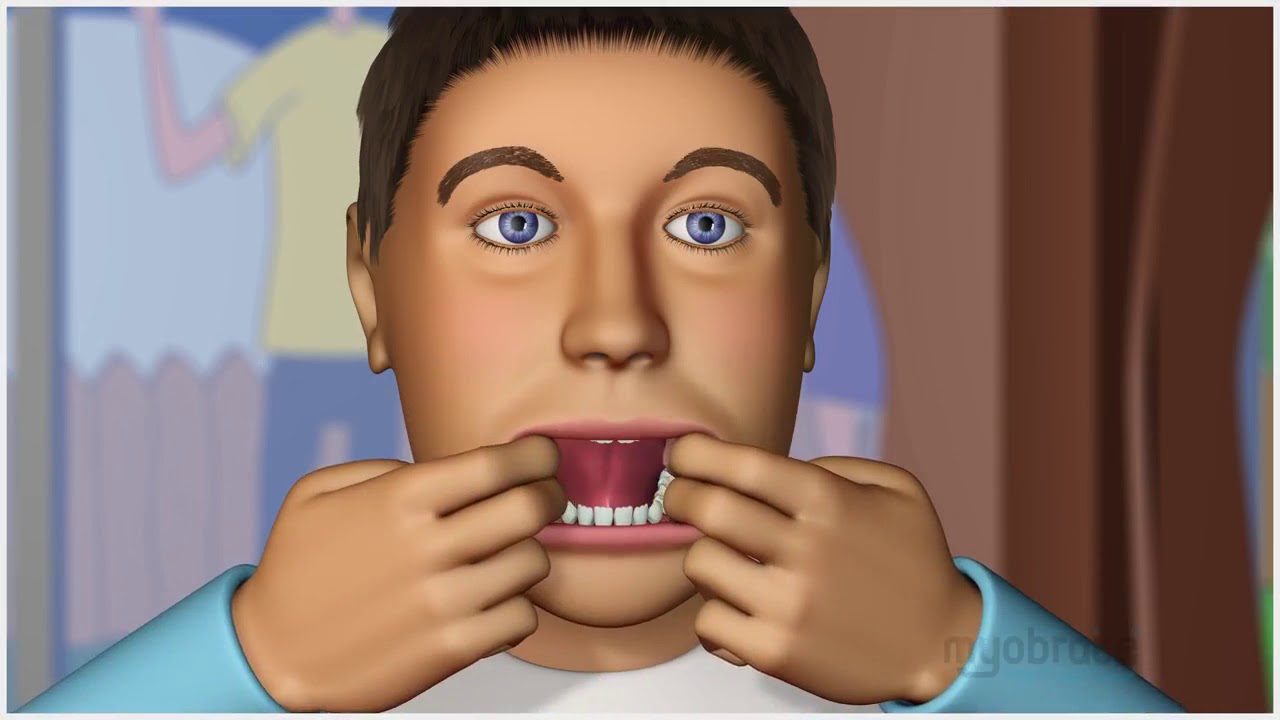 Myobrace Introduction for Parents and Patients