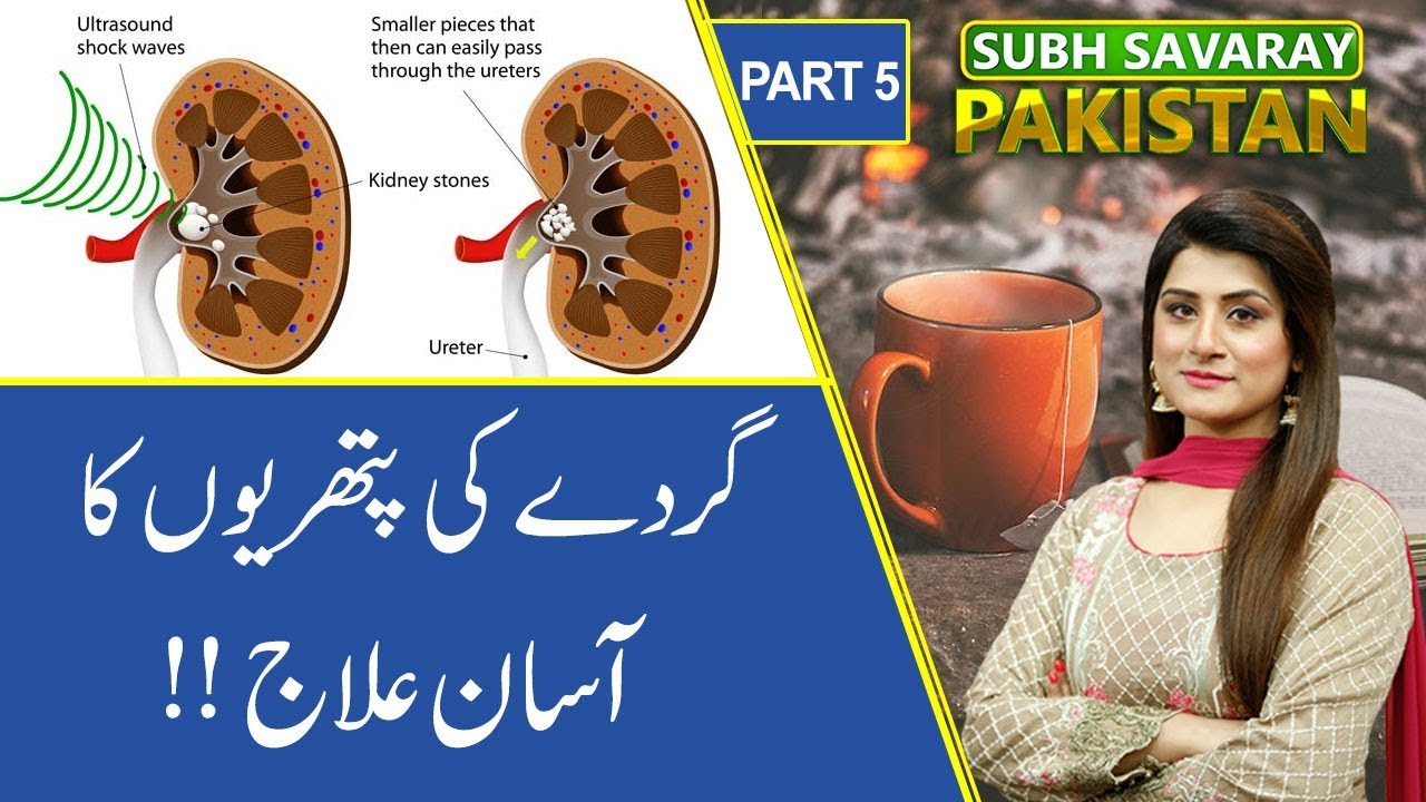 Subh Savaray Pakistan (Part 5) | Treatment of Kidney Stones | 19 October 2019 | 92NewsHD