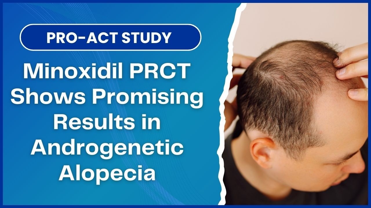 PRO-ACT Study Shows Better Outcomes with Minoxidil PRCT for Androgenetic Alopecia