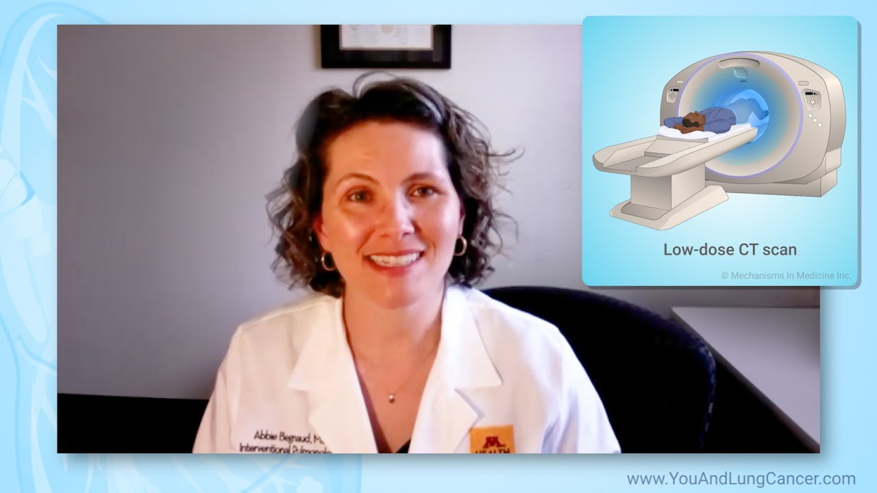 What should I expect during a low-dose CT lung cancer screening scan?