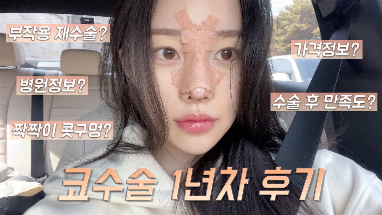 부작용 생겨서 재수술 했어요🥲 코수술 1년차 후기와 Q&AㅣMINCARONG