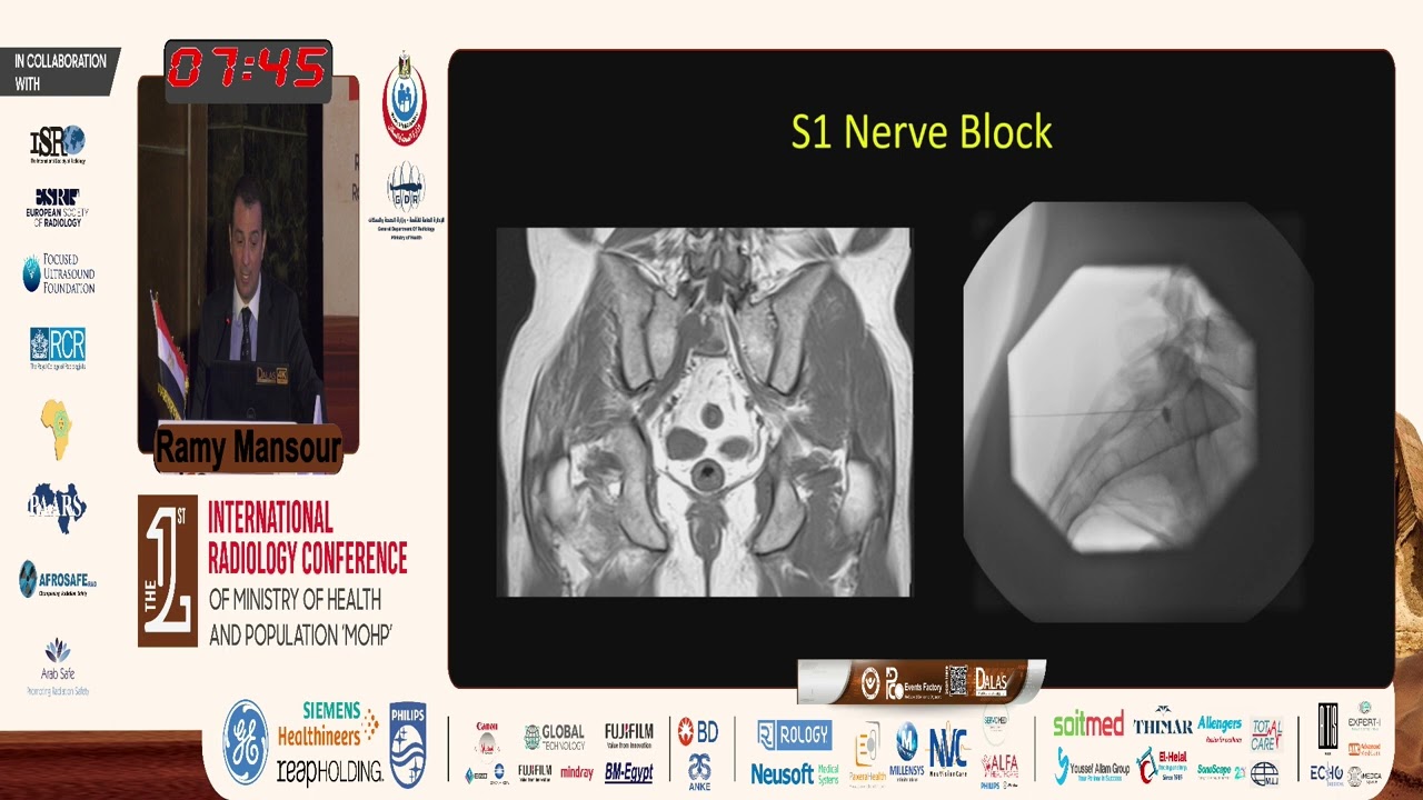 Image-guided Spinal Intervention