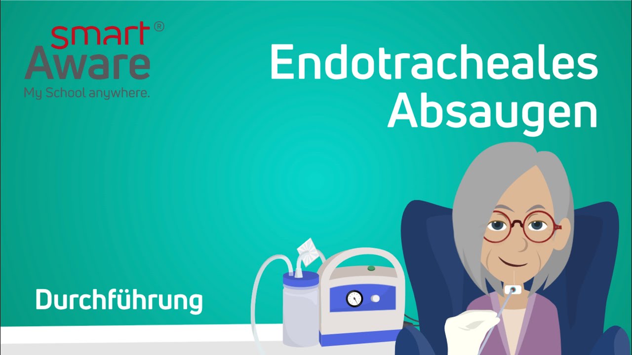 Endotracheales Absaugen | Durchf&uuml;hrung | Intensiv- und Beatmungspflege