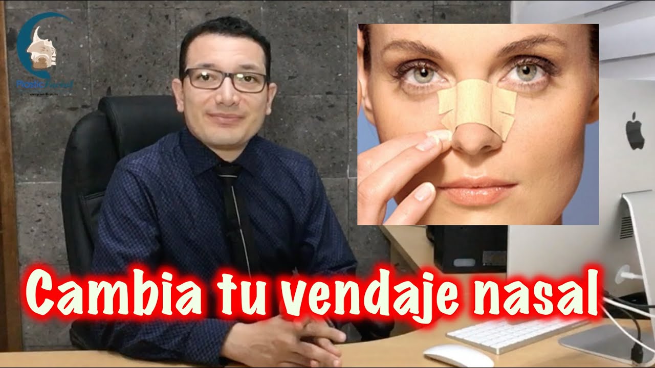 TUTORIAL Cambio del PARCHE NASAL despu&eacute;s de una RINOPLAST&Iacute;A - PlasticFacial MX