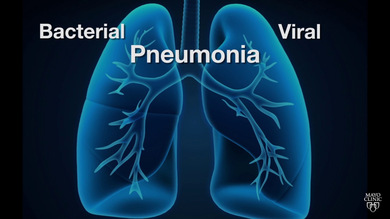 Mayo Clinic Minute: Is pneumonia bacterial or viral?