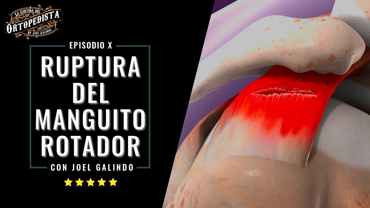 Rupturas del manguito rotador