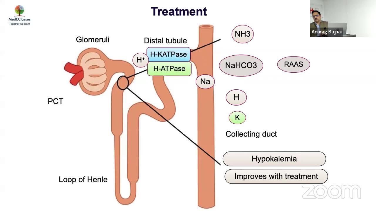 MedEClasses Grand Round Renal Tubular Acidosis