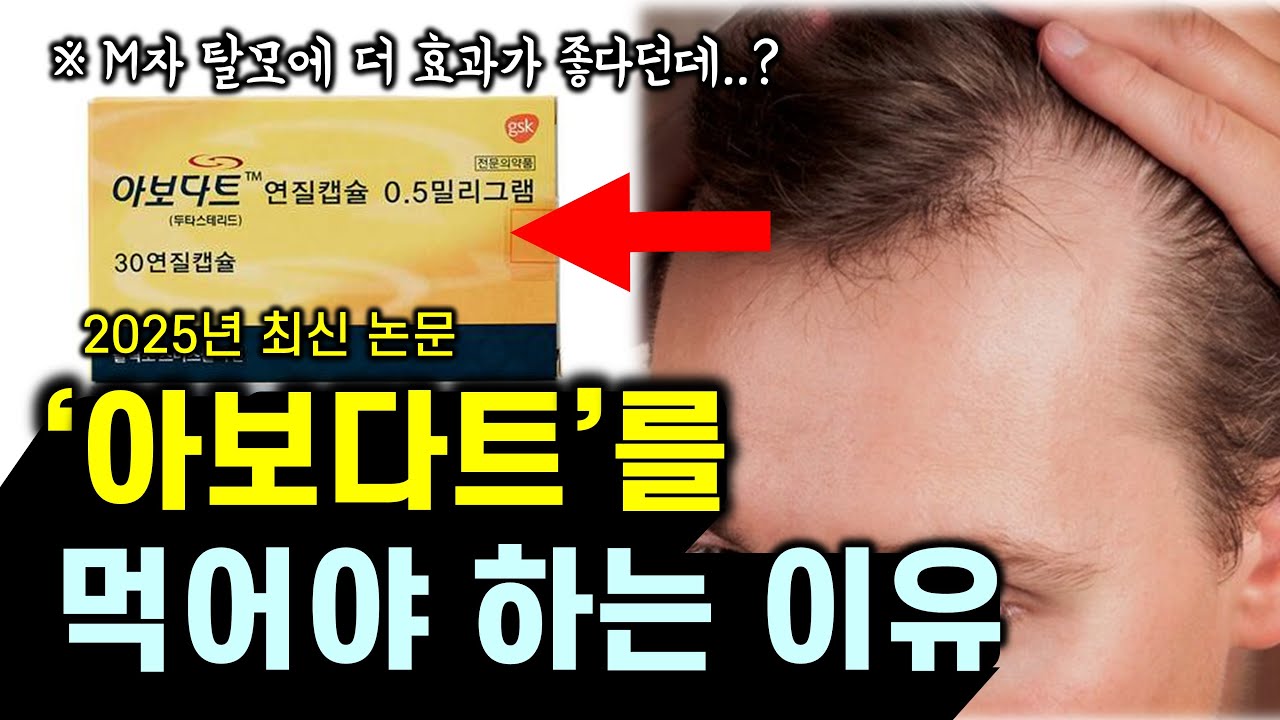 프로페시아 먹다가 아보다트로 갈아탔더니.......  feat. 탈모약 복용후기ㅣ효과, 부작용 비교ㅣ2025 최신 논문근거
