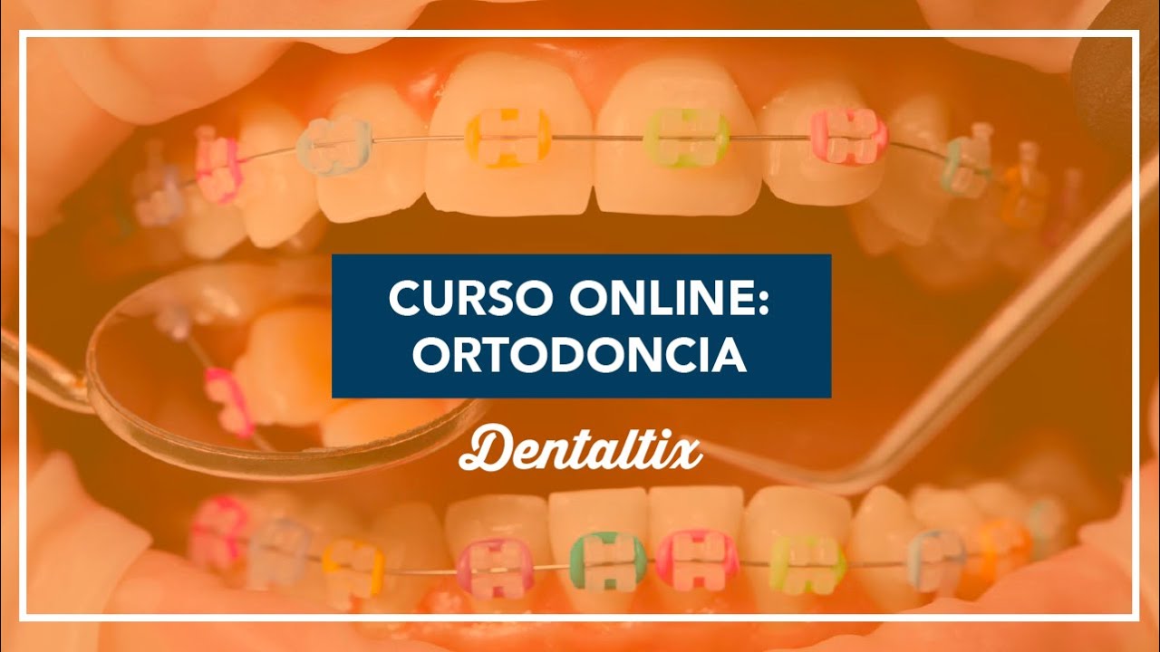 Curso online de ortodoncia: La técnica del autoligado pasivo, Universal Smile System