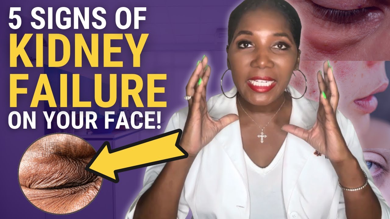 5 Warning Signs Of Kidney Disease Written On Your Face! Here's What You Should Know
