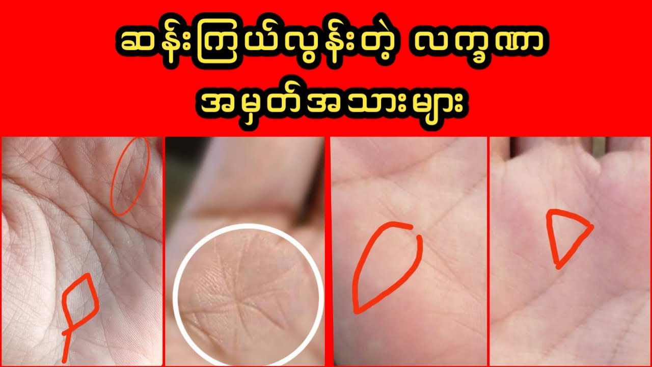ဆန်းကြယ်လွန်းတဲ့ လက္ခဏာများစုစည်းမူ