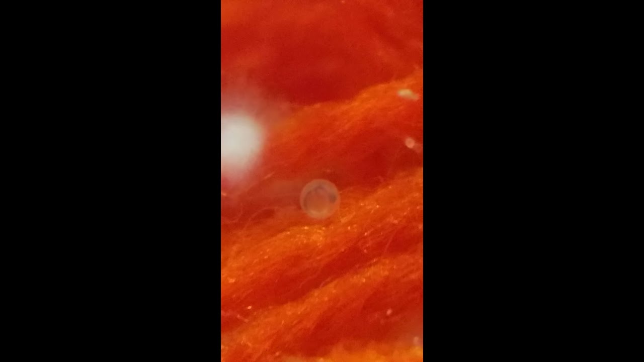 GOLDFISH EGGS (fertilized and unfertilized)
