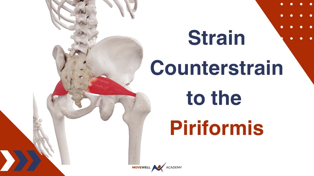How to do a Strain-Counterstrain technique to the Piriformis muscle