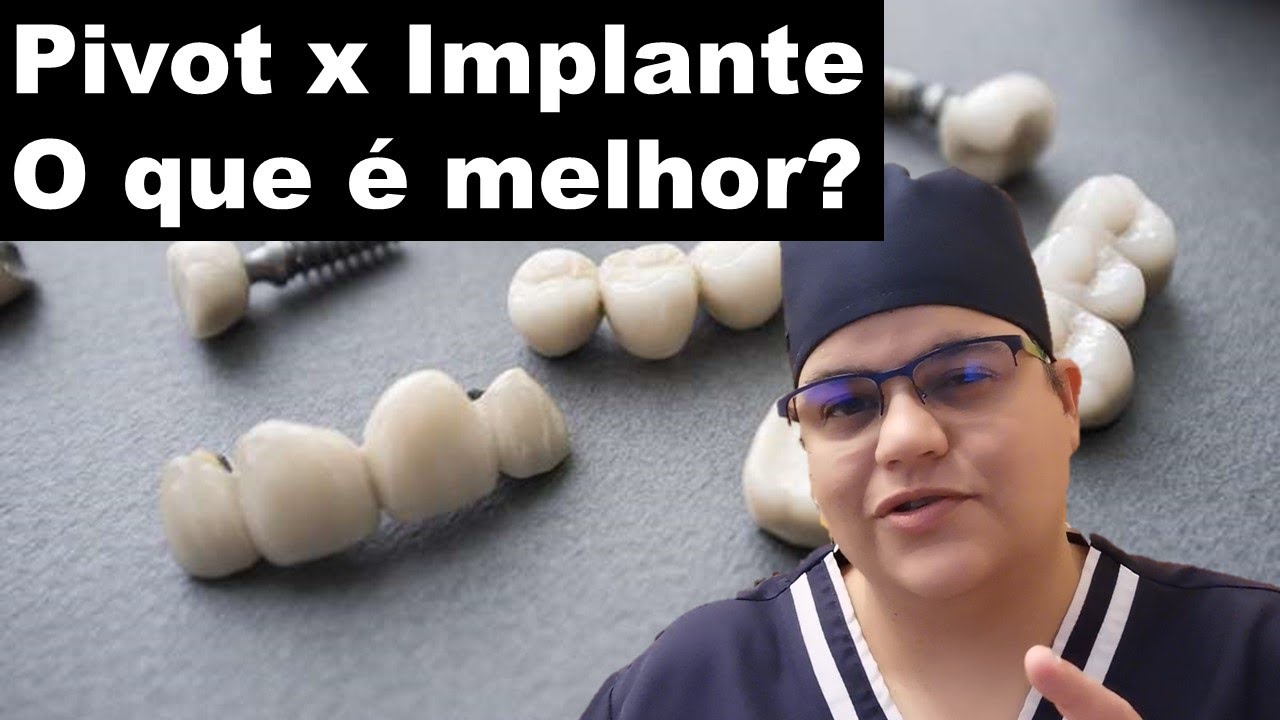 Pivô x Implante qual é melhor? | Dra Bianca Rosa | Clínica Bianca Rosa