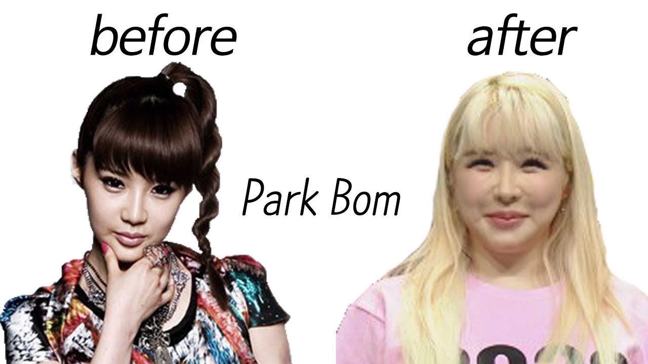 Park Bom before and After