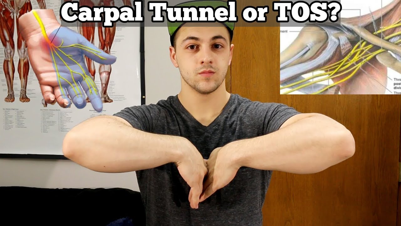 Carpal Tunnel or Thoracic Outlet Syndrome (TOS)?