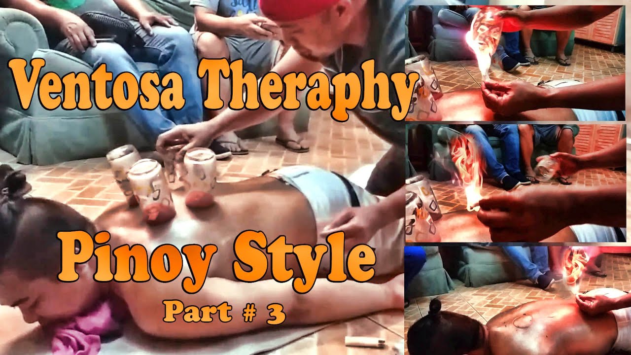 VENTOSA PINOY STYLE (Part 3)  - TRADITIONAL MASSAGE | OFW VLOG