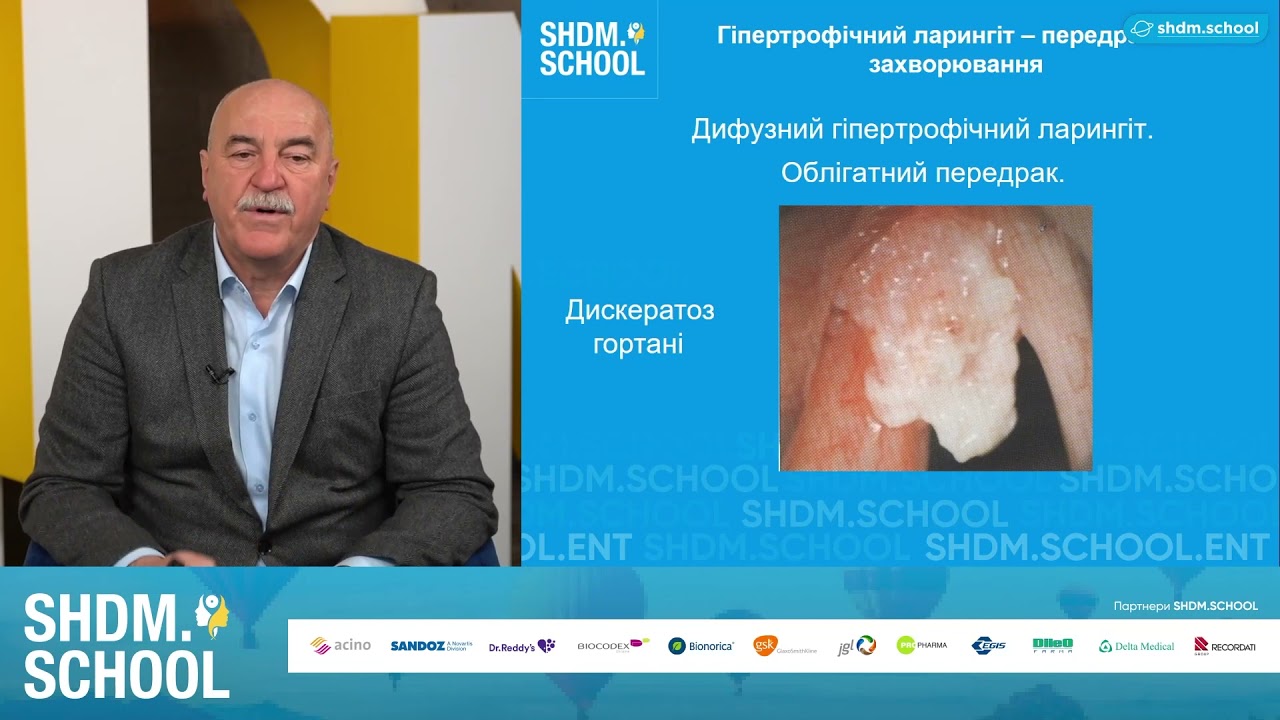 Хронічний ларингіт, як передрак гортані