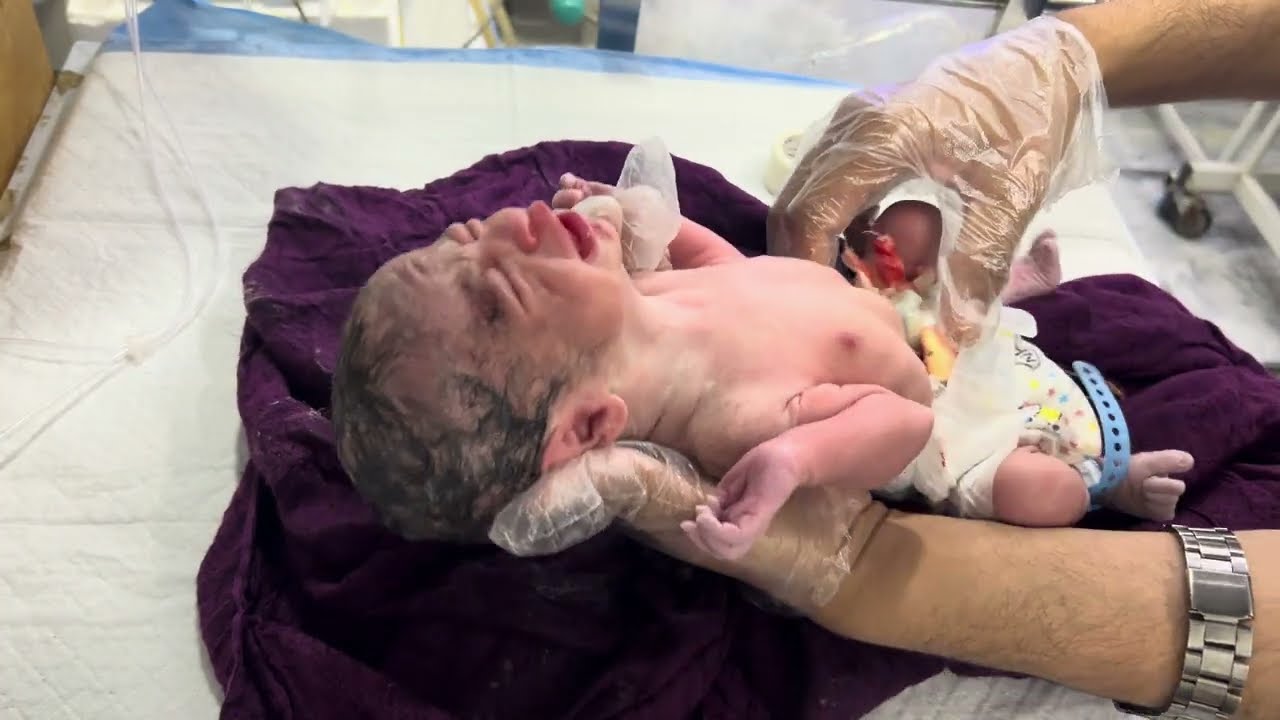 27 Week Premature Baby | Good Condition After Birth | Emergency Care & First Cry in NICU #care