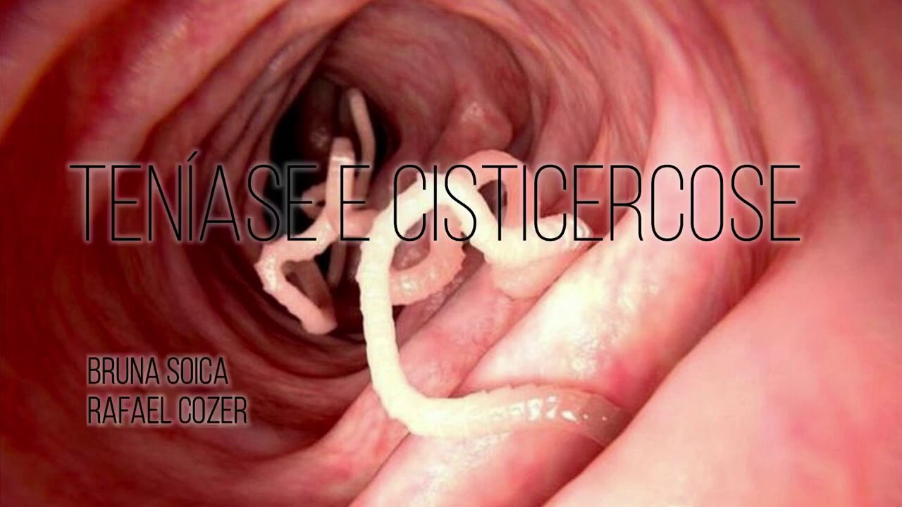 Ten&iacute;ase e Cisticercose